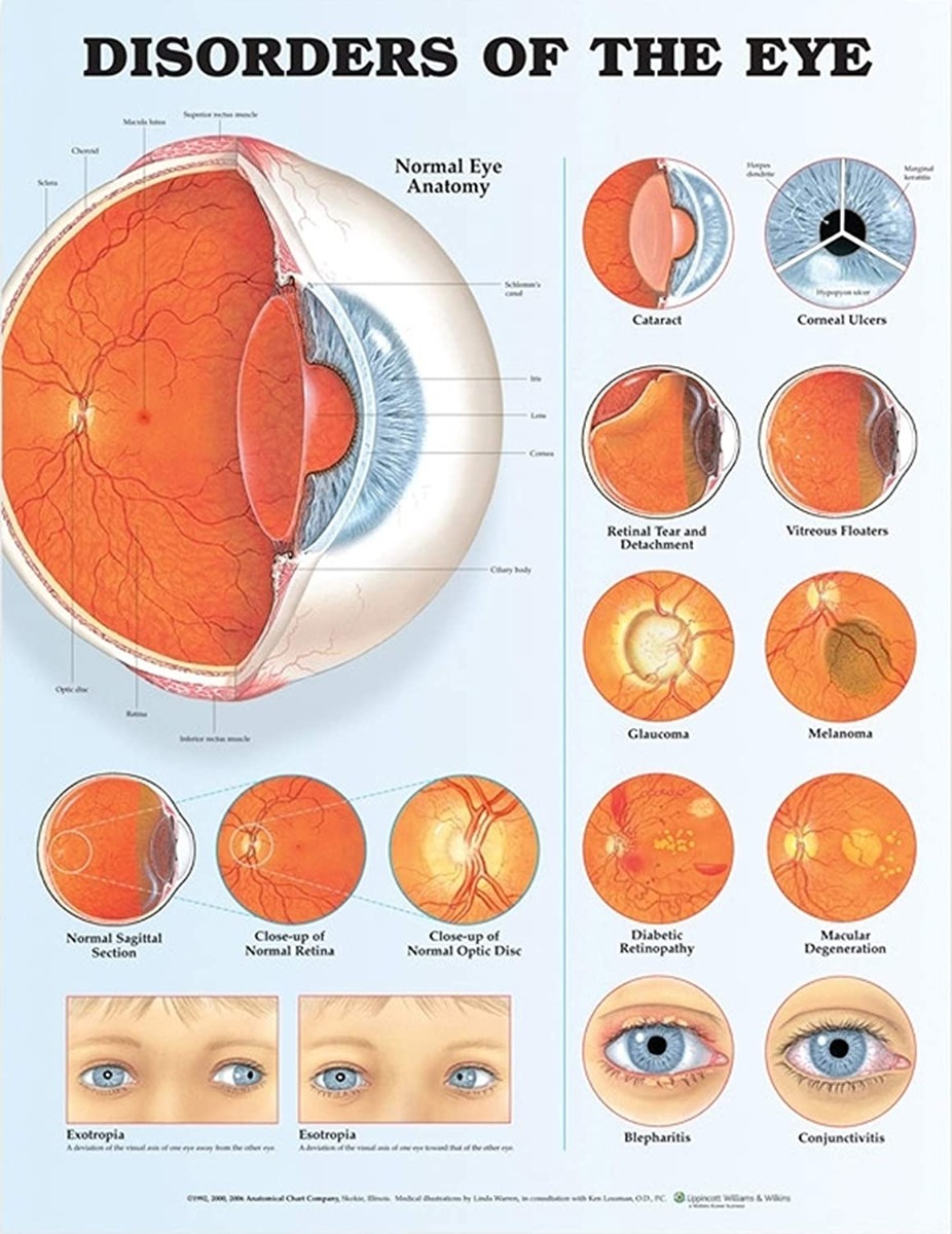 Eye-disorder-chart